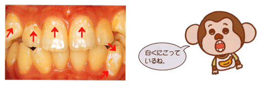 白くにごっているね